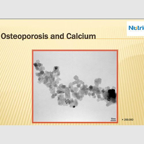 OSTEOPOROSIS AND CALCIUM